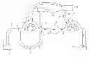 Fig. 01 - System for distending body tissue cavities by continuous flow irrigation