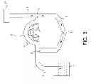 Fig. 04 - System for distending body tissue cavities by continuous flow irrigation