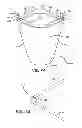 Fig. 08 - Trocar cannula anchor and seal