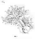 Fig. 02 - Surgical access system and related methods