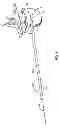 Fig. 07 - Surgical access system and related methods