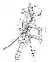 Fig. 09 - Surgical access system and related methods