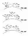 Fig. 35 - ADHESIVELY MOUNTED APPARATUS FOR DETERMINING PHYSIOLOGICAL AND CONTEXTUAL STATUS