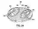 Fig. 29 - ADHESIVELY MOUNTED APPARATUS FOR DETERMINING PHYSIOLOGICAL AND CONTEXTUAL STATUS