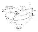 Fig. 32 - ADHESIVELY MOUNTED APPARATUS FOR DETERMINING PHYSIOLOGICAL AND CONTEXTUAL STATUS