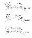 Fig. 34 - ADHESIVELY MOUNTED APPARATUS FOR DETERMINING PHYSIOLOGICAL AND CONTEXTUAL STATUS