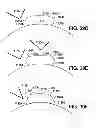 Fig. 35 - ADHESIVELY MOUNTED APPARATUS FOR DETERMINING PHYSIOLOGICAL AND CONTEXTUAL STATUS