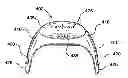 Fig. 01 - Adhesively mounted apparatus for determining physiological and contextual status