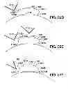 Fig. 35 - Adhesively mounted apparatus for determining physiological and contextual status