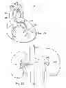 Fig. 03 - System and Method for Multi-Site Intravascular Measurement