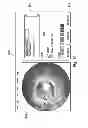 Fig. 12 - System and Method for Multi-Site Intravascular Measurement