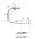 Fig. 01 - Means for securing a catheter into a vessel