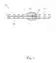 Fig. 04 - Means for securing a catheter into a vessel