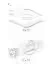 Fig. 11 - Means for securing a catheter into a vessel