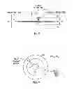 Fig. 06 - Aspirating and removing biological material