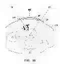 Fig. 08 - AORTIC ARTERY MEASURING PROBE, DEVICE AND METHOD OF MEASURING DIAMETER OF AORTIC ARTERY