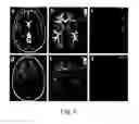 Fig. 07 - Methods and apparatuses for relating multiple magnetic resonance physical parameters to myelin content in the brain