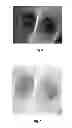 Fig. 06 - DETERMINING POSITION OF MEDICAL DEVICE IN BRANCHED ANATOMICAL STRUCTURE