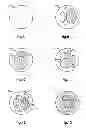 Fig. 07 - DETERMINING POSITION OF MEDICAL DEVICE IN BRANCHED ANATOMICAL STRUCTURE