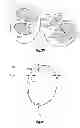 Fig. 10 - DETERMINING POSITION OF MEDICAL DEVICE IN BRANCHED ANATOMICAL STRUCTURE
