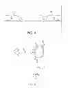 Fig. 04 - FIDUCIARY MARKERS AND METHODS OF PLACEMENT