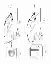 Fig. 07 - INTRODUCER HAVING A FLOW SENSOR