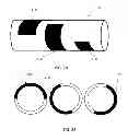 Fig. 03 - CATHETER ORIENTING MARKERS