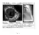 Fig. 06 - Locating intravascular images