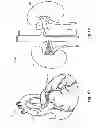 Fig. 03 - System and Method for Precisely Locating an Intravascular Device