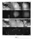 Fig. 06 - PORTABLE DIGITAL IMAGING SYSTEM FOR FLUORESCENCE-GUIDED SURGERY