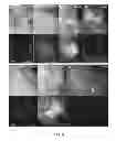 Fig. 07 - PORTABLE DIGITAL IMAGING SYSTEM FOR FLUORESCENCE-GUIDED SURGERY