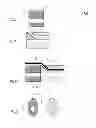 Fig. 03 - Smooth transition catheters