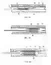 Fig. 03 - TISSUE ABLATION CATHETER AND METHODS OF ABLATING TISSUE