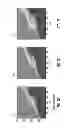 Fig. 04 - Method for Estimating Pressure Gradients and Fractional Flow Reserve from Computed Tomography Angiography: Transluminal Attenuation Flow Encoding