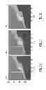 Fig. 06 - Method for Estimating Pressure Gradients and Fractional Flow Reserve from Computed Tomography Angiography: Transluminal Attenuation Flow Encoding