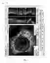 Fig. 07 - SYSTEM AND METHOD FOR FLUSH-TRIGGERED IMAGING