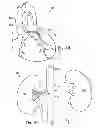 Fig. 03 - Display control for a multi-sensor medical device
