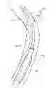 Fig. 01 - SYSTEM AND METHOD FOR GUIDEWIRE CONTROL
