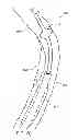 Fig. 11 - SYSTEM AND METHOD FOR GUIDEWIRE CONTROL