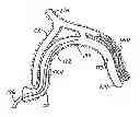 Fig. 01 - Tissue Penetrating Catheters Having Integral Imaging Transducers and Their Methods of Use
