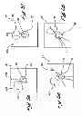 Fig. 07 - Tissue Penetrating Catheters Having Integral Imaging Transducers and Their Methods of Use