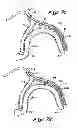 Fig. 09 - Tissue Penetrating Catheters Having Integral Imaging Transducers and Their Methods of Use