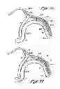 Fig. 10 - Tissue Penetrating Catheters Having Integral Imaging Transducers and Their Methods of Use