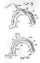 Fig. 11 - Tissue Penetrating Catheters Having Integral Imaging Transducers and Their Methods of Use