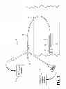 Fig. 02 - Method of ablating arterial plaque