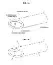 Fig. 04 - ULTRASONIC PIERCING NEEDLE