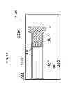 Fig. 09 - INTRALUMINAL IMAGING SYSTEM