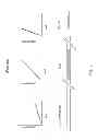 Fig. 02 - INTRALUMINAL DEVICE HAVING ENHANCED DELIVERABILITY