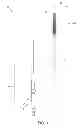 Fig. 02 - CATHETER WITH BALLOON AND IMAGING