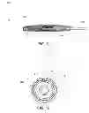 Fig. 07 - CATHETER WITH BALLOON AND IMAGING